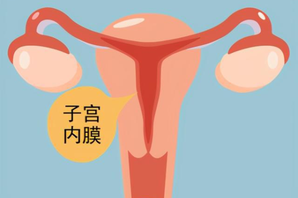 多囊卵巢综合症原因与治疗：如何影响生育及助孕选择