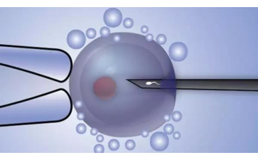 孕期饮食指南：4种食物助排胎毒，预防胎儿黄疸